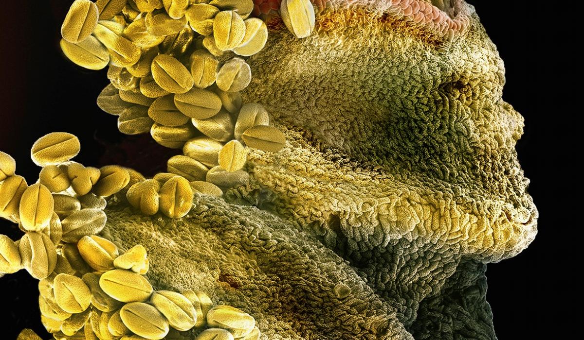 Faszination Mikrokosmos, Anita Reinsch